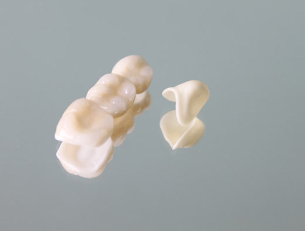 Préparation de dents antérieures
