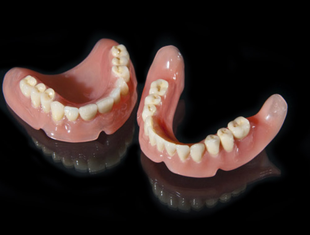Dentier complet